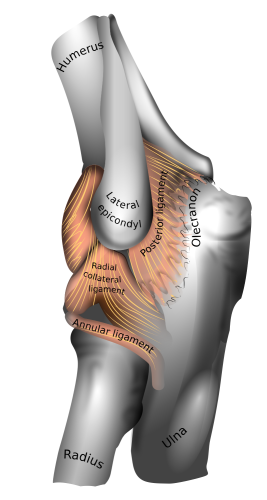 Tennis elbow