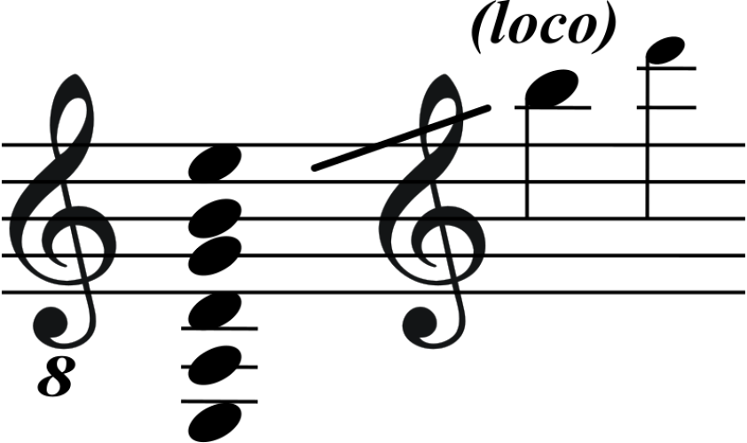 E-Gitarre