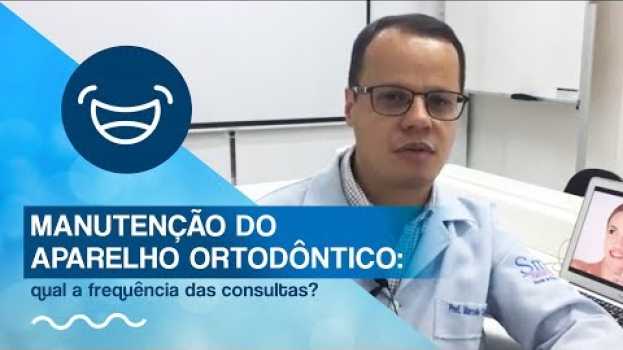 Video Manutenção do aparelho ortodôntico: qual a frequência das consultas? en español