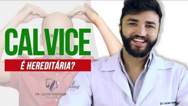 Video Calvice É HEREDITÁRIA: Será que vou ficar Careca? | Dr  Lucas Fustinoni auf Deutsch