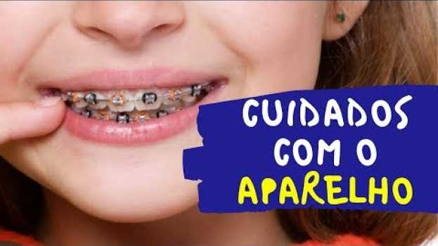 Video O que não pode comer com aparelho fixo su italiano