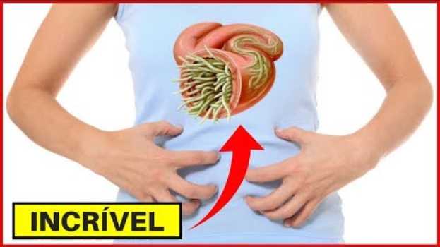 Video 10 SINAIS DE QUE VOCÊ PODE ESTAR COM AMEBA E OUTROS PARASITAS E COMO ELIMINÁ-LOS !! auf Deutsch