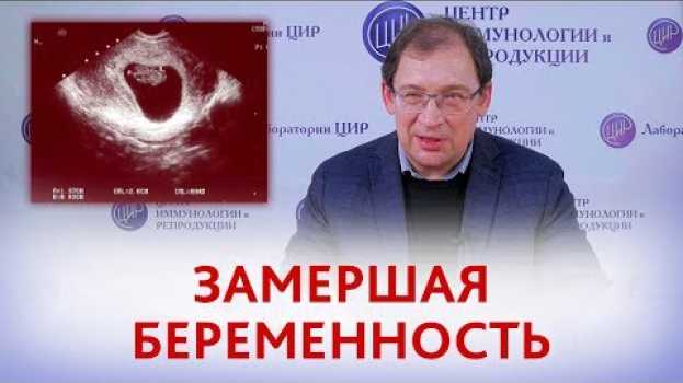 Video Замершая беременность. Причины и что делать, если была замершая беременность. Отвечает Гузов И.И. auf Deutsch