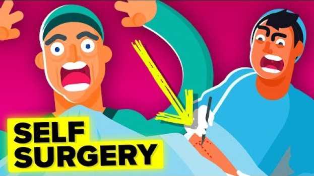 Video Why A Doctor Removed His Own Appendix auf Deutsch