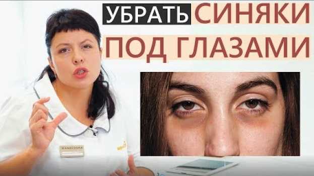 Video 👍Как убрать синяки под глазами 😱👍 Патчи и процедуры от синяков под глазами👍 auf Deutsch