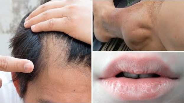 Video 6 Sinais que Você Pode ter Deficiência de Vitamina B e D, e Minerais! su italiano