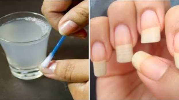 Video Dopo averlo fatto, le sue unghie sono cresciute velocemente. Lo ha detto un amico dermatologo   türkçe