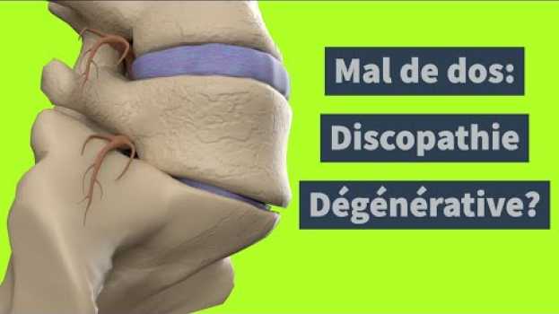 Video Discopathie Dégénérative: Pourquoi ça fait mal et comment soulager? en español