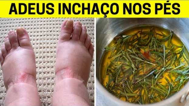Video Seu INCHAÇO NOS PÉS E PERNAS Vai Desaparecer na Hora que Você Usar Este Remédio Caseiro ! in English