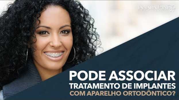 Video Pode Associar Tratamento de Implantes com Aparelho Ortodôntico? | Ianara Pinho en español