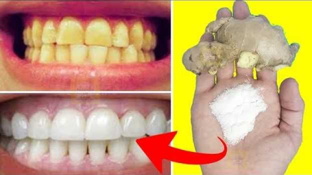 Video DENTES BRANCOS Clareados e Brilhantes Como Pérola │ Receita Caseira Para Clarear os Dentes auf Deutsch