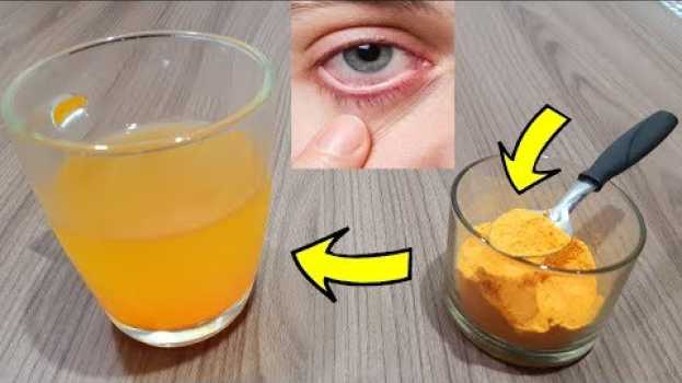 Video MINHA NOSSA! Nunca Pensei que AÇAFRÃO Poderia Fazer Isso Com a Visão, Glaucoma, Catarata e Miopia en français
