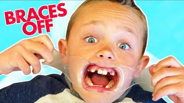 Video I Had a Crazy Dream I Got My Braces Off! Kade Skye   türkçe