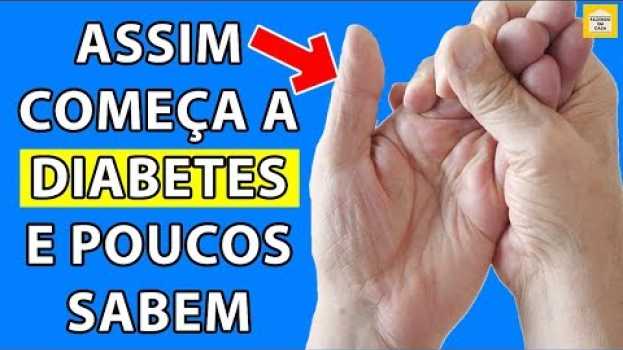 Video Se Você Tiver Algum Desses Sintomas Pode Ser Início de DIABETES e NÃO SABE | FIQUE ATENTO in English