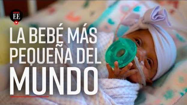 Video La bebé más pequeña del mundo nace en EEUU: pesó lo mismo que una manzana | El Espectador auf Deutsch
