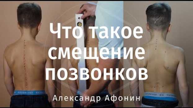 Video Что такое смещение позвонков и зачем упражнения после мануальной терапии su italiano