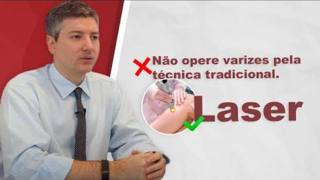 Video Cirurgia de varizes: Laser? Tradicional? O que fazer?   türkçe