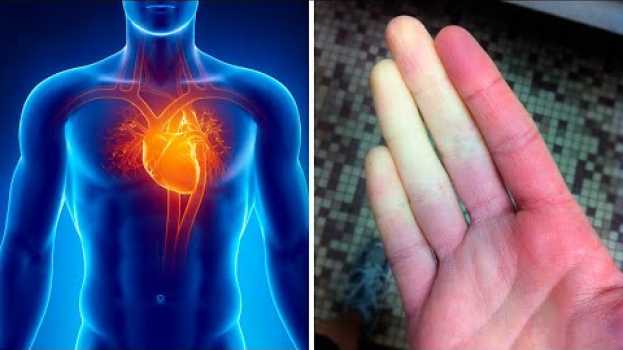 Video This Is Why Your Hands And Feet Are Always Cold su italiano