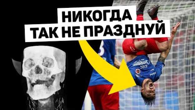 Video ЗАБИЛ ГОЛ И УМЕР. Серьезные травмы при праздновании голов. Футбольный топ. @120 ЯРДОВ em português