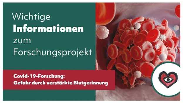 Видео Covid-19-Forschung: Thrombosegefahr durch verstärkte Blutgerinnung на русском