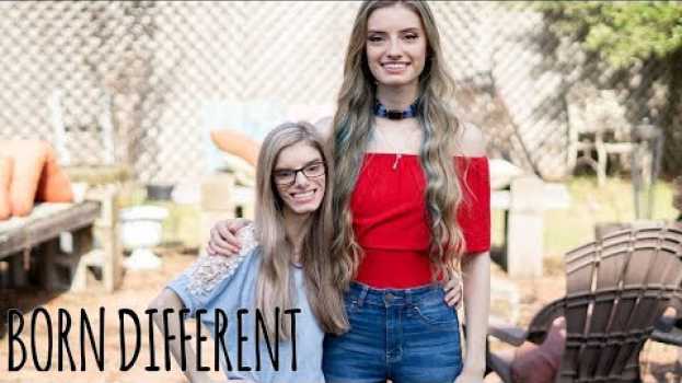 Video My Identical Twin With Dwarfism | BORN DIFFERENT po polsku