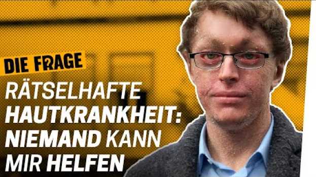 Video Seltene Krankheit: Mein Leben ohne Heilung | Wie lebe ich mit einer schweren Krankheit? Folge 7 in English