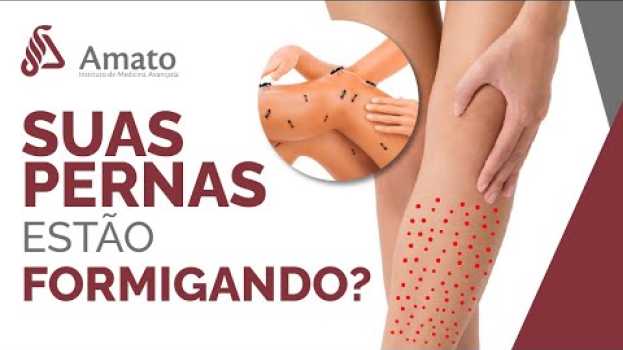 Video Formigamento das pernas pode ser um problema vascular. po polsku