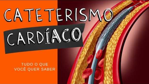 Видео CATETERISMO CARDÍACO: Tudo o que você quer saber! на русском