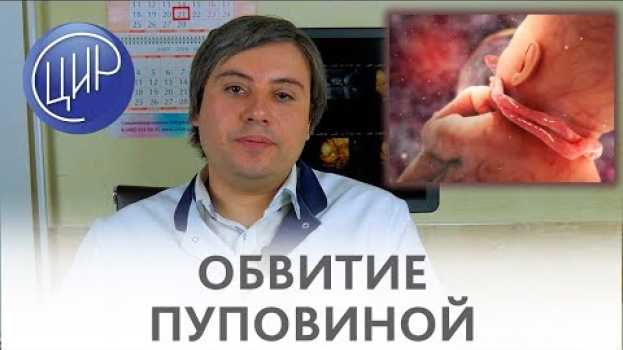 Video ОБВИТИЕ ПУПОВИНОЙ вокруг шеи. Бояться ли обвития пуповиной? Курганников А.С. po polsku
