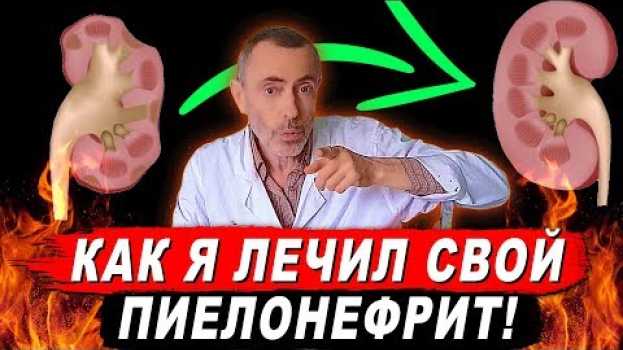 Video КАК Я ЛЕЧИЛ СВОЙ ПИЕЛОНЕФРИТ! МОЖНО ЛИ ЗАСТУДИТЬ ПОЧКИ!? Болят почки, очищение почек. Островский en français