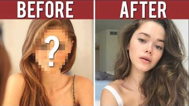 Video Why I Had A Nose Job At 16   türkçe