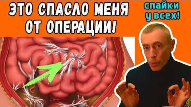 Video ЭТО СПАСЛО МЕНЯ ОТ ОПЕРАЦИИ! СПАЙКИ У ВСЕХ! Островский. Кишечник, пищеварение, опущение внутренних em português