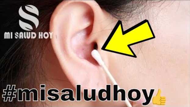 Video 🔵Sabias Que El Cerumen Del Oído Puede Decir Mucho Acerca De Tu Salud - Limpiar Los Oidos su italiano
