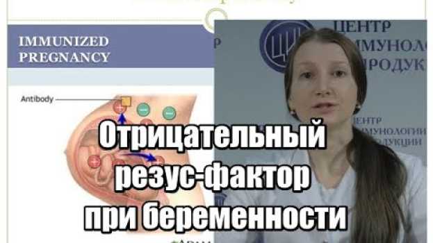 Video Резус при беременности. Резус-конфликт. Отрицательный резус-фактор во время беременности. em português