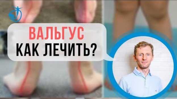 Video ВАЛЬГУС - Вальгусная деформация стоп у детей. Как лечить? Владимир Животов in English