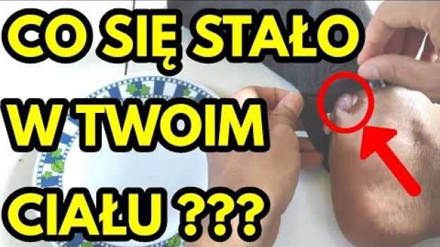 Video Jeśli codziennie kładziesz cebulę na stopach, co stanie się z twoim ciałem ? auf Deutsch