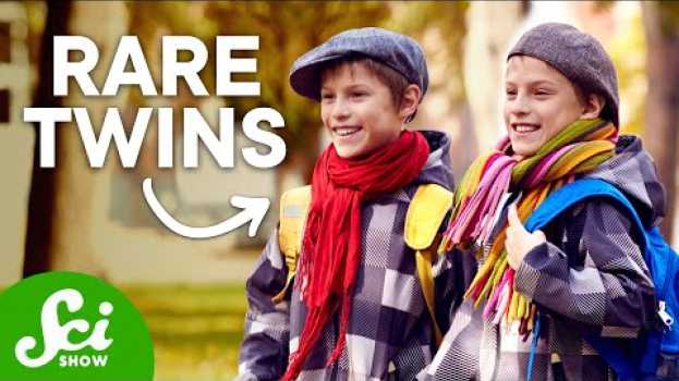Video 6 Types of Twins That Are Extremely Rare auf Deutsch
