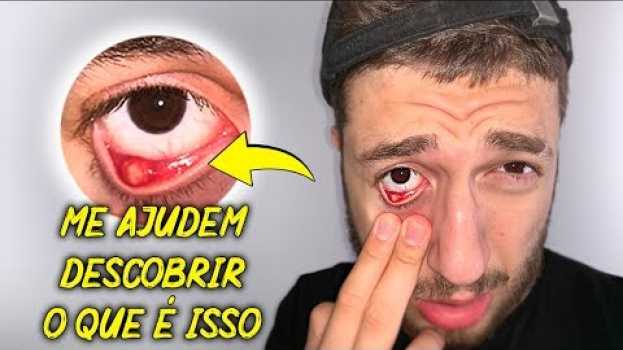 Video ISSO SURGIU DENTRO DO MEU OLHO DO NADA!!! en español