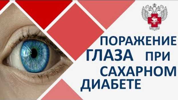 Video Сахарный диабет и зрение. 👁 Диагностика и лечение зрения при сахарном диабете. Пироговский центр. in English