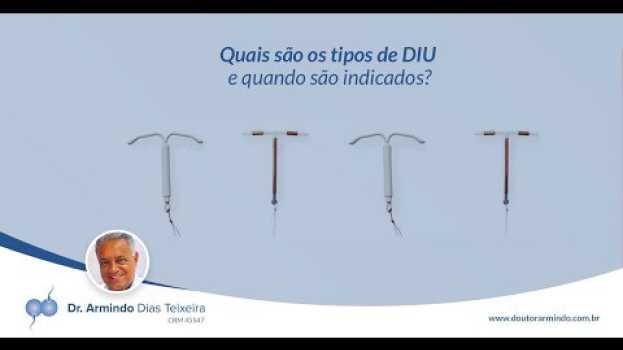 Видео Quais são os tipos de DIU e quando são indicados | Dr. Armindo Teixeira на русском