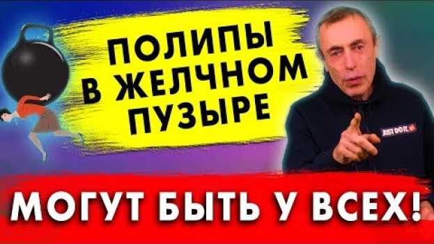 Video ПОЛИПЫ В ЖЕЛЧНОМ ПУЗЫРЕ МОГУТ БЫТЬ У ВСЕХ! Холецистит, желчный пузырь - застой. Островский in English