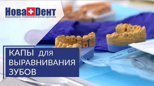 Video Капы для зубов. 🌞 Исправление прикуса с помощью капы для зубов. НоваДент. 12+ in English