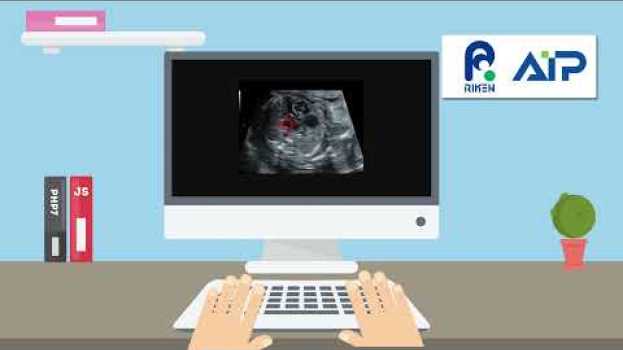 Video Explanatory artificial intelligence improves the diagnosis of congenital heart defects before birth auf Deutsch