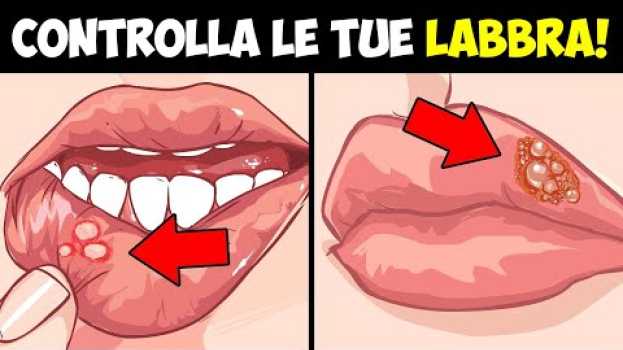 Video 9 segnali di avvertimento per la salute da parte delle tue labbra en français