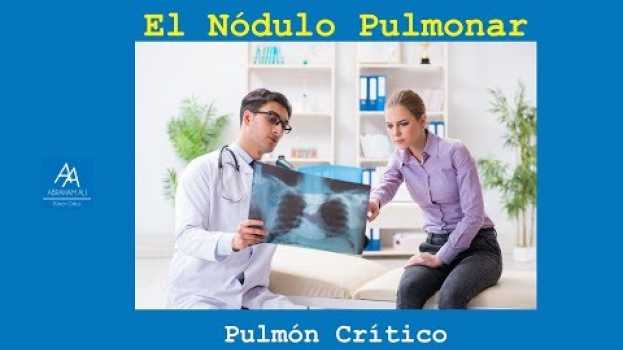 Video Nódulo Pulmonar no siempre es igual a Cáncer auf Deutsch