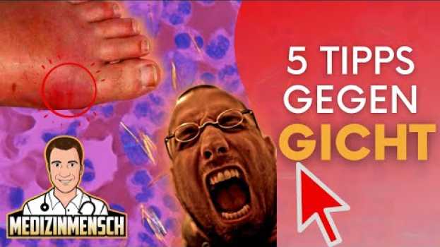 Видео GICHTANFALL? Was Gegen Gicht Im Fuß Hilft | 5 Sofort-Tipps die Schmerzen lindern на русском