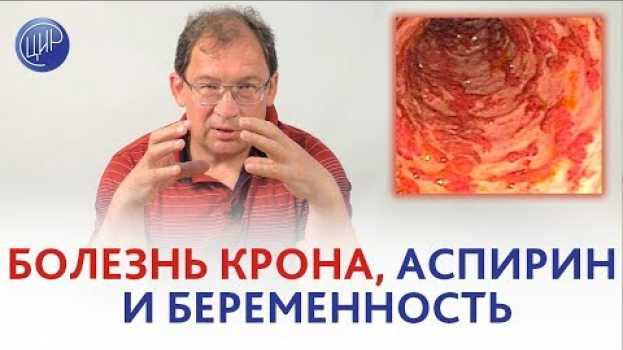 Video БОЛЕЗНЬ КРОНА, аспирин и беременность. МОЖНО ЛИ пить АСПИРИН при болезни Крона?   türkçe