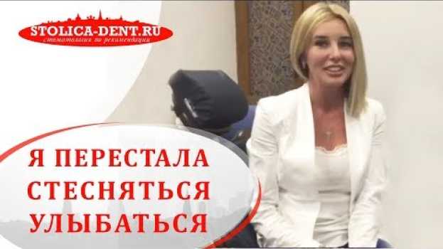 Video 💬 Отзыв о ношении брекетов и результатах после их снятия. Брекеты после снятия. 12+ en español