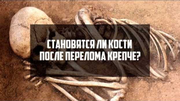 Video Становятся ли кости после перелома крепче? | DeeaFilm en français