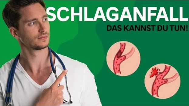 Video So erkennst du einen Schlaganfall! in English